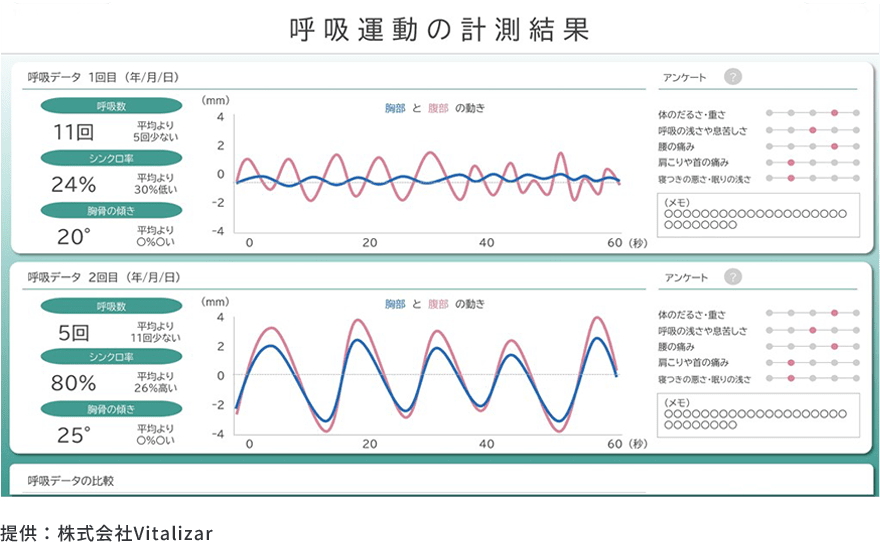 呼吸運動の計測結果